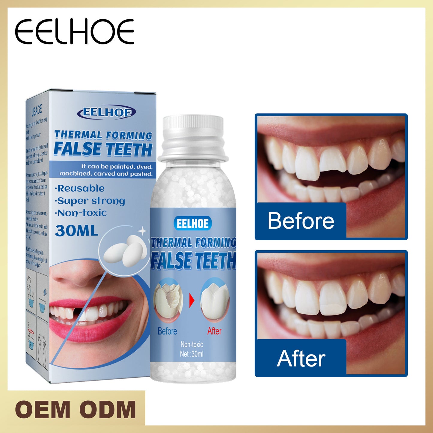 EELHOE plastic teether temporary fillings for filling holes dentures modification