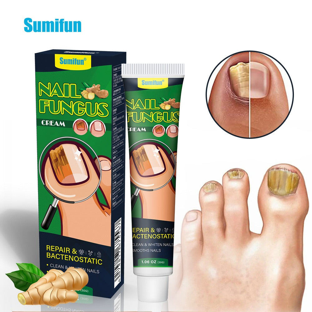 Onychomycosis care cream nail polish 30g