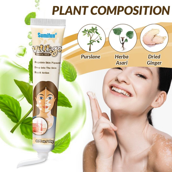 Vitiligo Cream, Vitiligo Care Cream for Skin Vitiligo, Psoriasis, Leukoplakia - Reduces White Spots