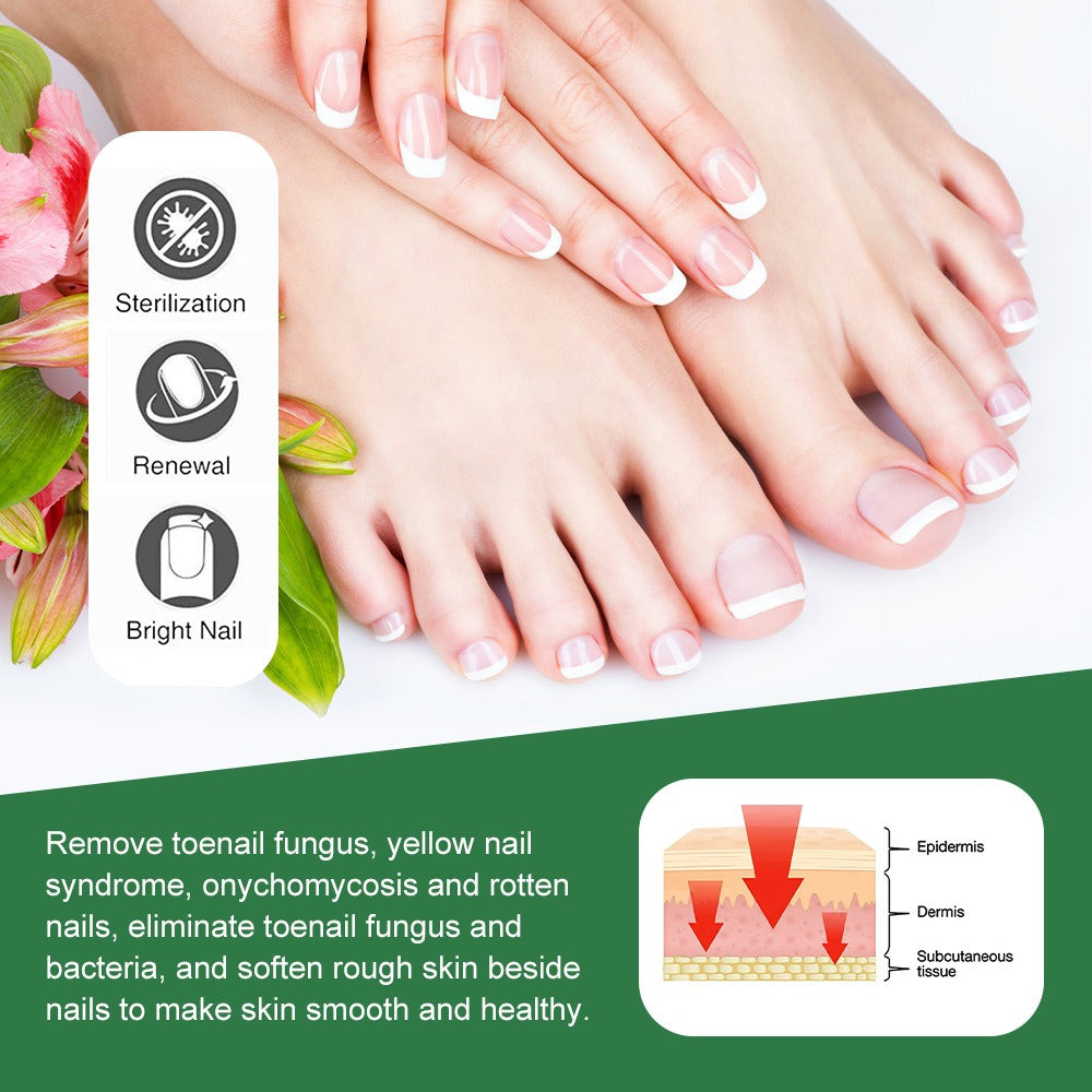 Onychomycosis care cream nail polish 30g