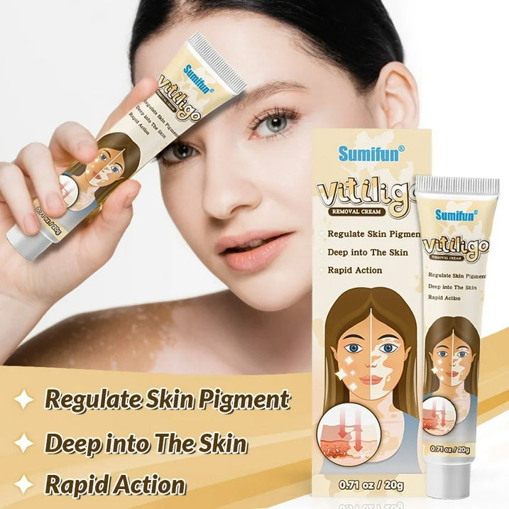 Vitiligo Cream, Vitiligo Care Cream for Skin Vitiligo, Psoriasis, Leukoplakia - Reduces White Spots