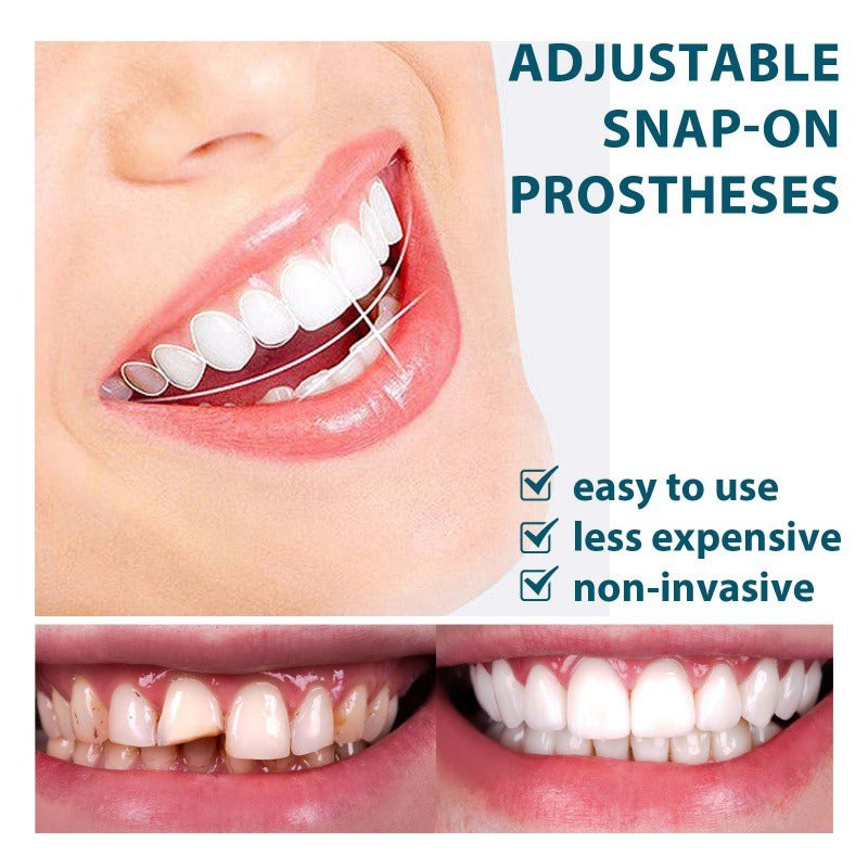 Adjustable snap-on dentures (Adjustable and easy to use)