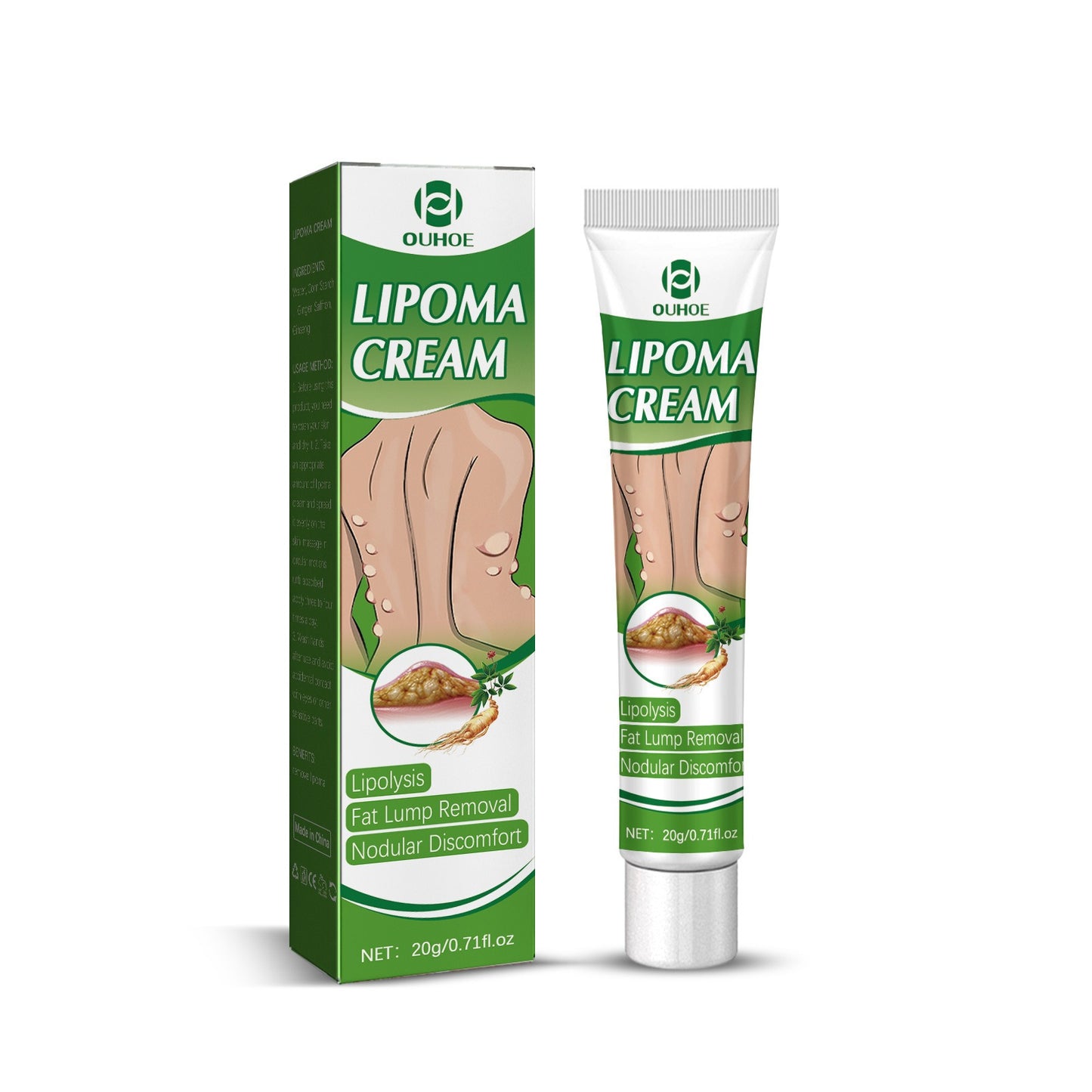 【Buy one get one free】OUHOE Fat Nodule Cream is a body care cream to clear away various fat nodules, subcutaneous lumps and lumps in the body.